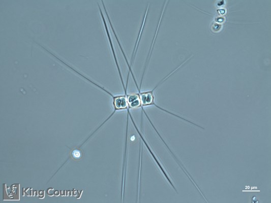 Photo of Chaetoceros similis